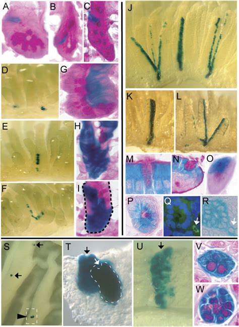 Lineage Tracing In The Small Intestine And Colon Histological Or Whole