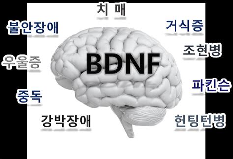 치매·우울증 단백질 생성 위치에 따라 조절 기능 달라진다한국뇌연구원 규명 전자신문