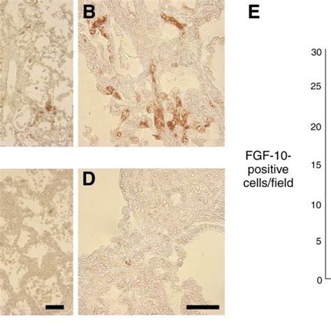 Fibroblast Growth Factor Fgf Is Reduced In Bronchopulmonary