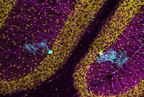 Foto Recordando a Cajal para tratar la neurodegeneración Un ovillo