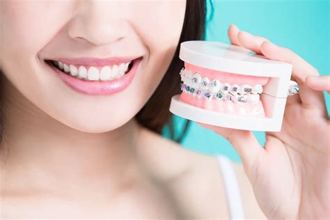 How To Fix Misaligned Front Teeth