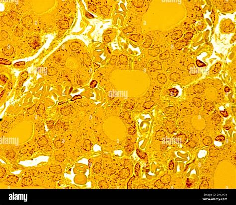 Thyroid gland follicles, light micrograph Stock Photo - Alamy