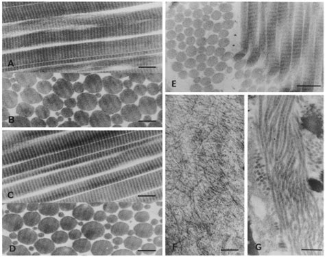 Transmission electron microscopy of collagen fibrils from tendon, skin... | Download Scientific ...