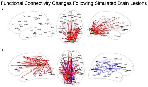 Frontiers Interpreting The Effects Of Altered Brain Anatomical