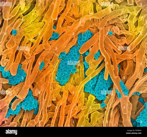 Streptomyces Coelicoflavus Bacterias Color An Lisis Micrograf A De