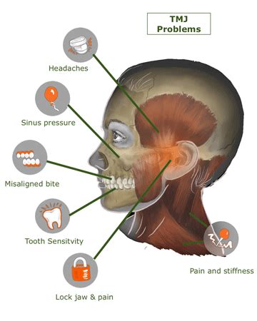 Jaw Pain Temporomandibular Joint Pain Complete Spine And Pain Care