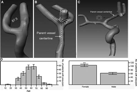 Presence Of Anterior Communicating Artery Aneurysm Is Associated With