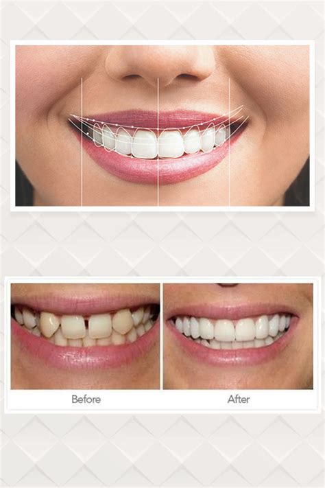 Smile Design Lasertech Medspa