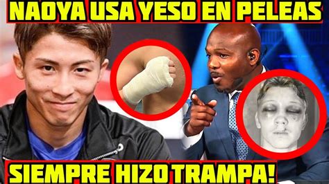 NAOYA INOUE Es Un TRAMPOSO Uso YESO En Todas Sus PELEAS La VERDAD