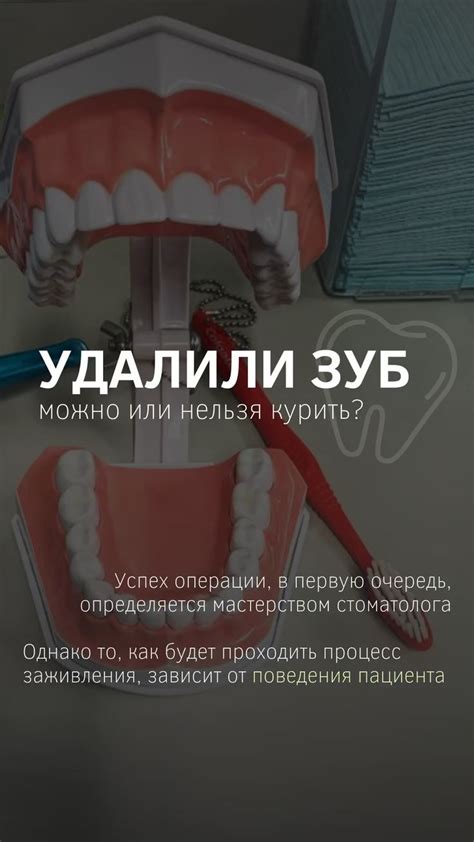 ИДЕИ ДЛЯ СТОРИС | стоматолог | Стоматология, Ортодонтия, Кариес