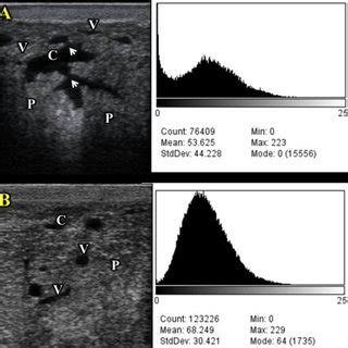 Ultrasonographic Examination Of Supramammary Lymph And Its Crossponding