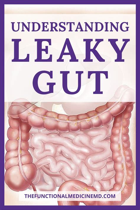 Understanding Leaky Gut Leaky Gut Functional Medicine Nursing School Tips