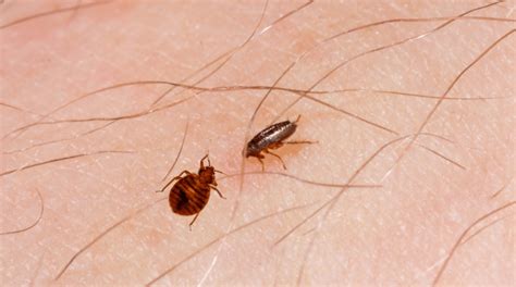 Bed Bug Bites Vs Flea Bites: Spotting The Difference - Pest Control Helper