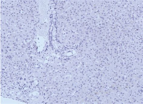 Negative Liver Staining For Scca Variants By Immunohistochemistry In Download Scientific