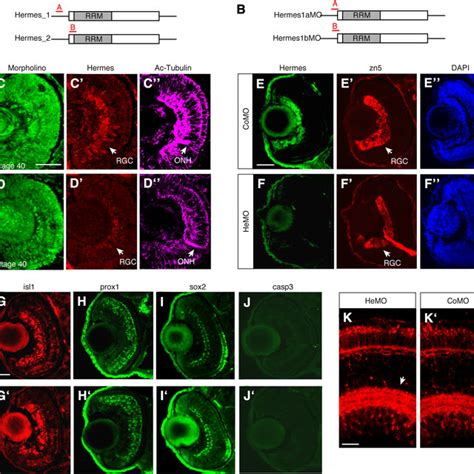 Hermes Depletion Does Not Alter Rgc Specification And Development A