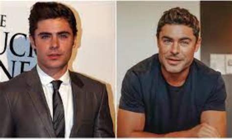 Zac Efron Confiesa El Motivo Del Cambio De Su Rostro — Noticias En La