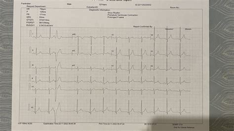 Had a huge PVC before this and now everything looks back to normal ...