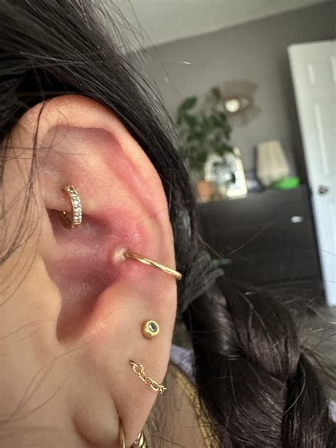 Irritation Bump R Piercing