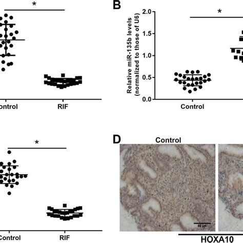 Expression Profiles Of Hsa Circ 0001946 Mir 135b And Hoxa10 In