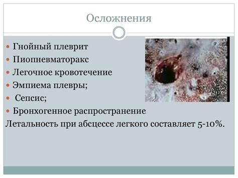 Абсцесс легких - презентация онлайн