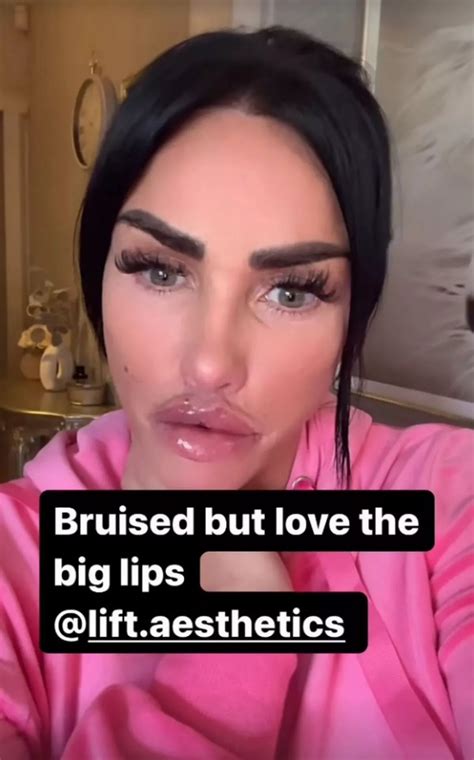 Katie Price Shows Off Biggest Ever Boobs In Bikini As Fans Share Concern Daily Star