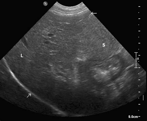 Imaging Of The Liver And Pancreas Vet Focus