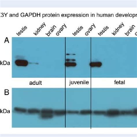 DDX3Y and GAPDH protein expression in adult, juvenile | Download ...