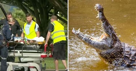 Man Bravely Fights Off Crocodile That Repeatedly Chomped On Him Before