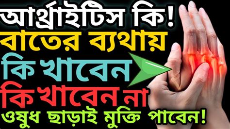 💥বাত ভুলে যান💥 আর্থ্রাইটিস কি বাতের ব্যথায় কি খাবেন ও কি খাবেন না বাতের ব্যথা দূর করার