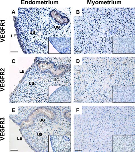 Protein Localization Of Vegfr1 Vegfr2 And Vegfr3 In Bovine Uterine