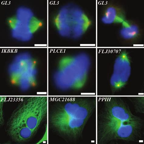 Examples Of Mitotic And Cytokinetic Defects After Rnai Of Indicated