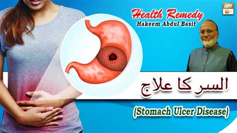 Maide Ke Alsar Ka Ilaj Stomach Ulcer Disease Hakeem Abdul Basit