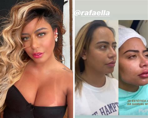 Rafaella Santos Antes E Depois Online Crescendocompetition Org