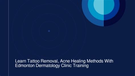 Learn Tattoo Removal Acne Healing Methods With Edmonton Dermatology