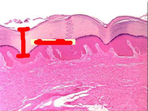 Bsci Lp Integumentary System Structure Identification Flashcards