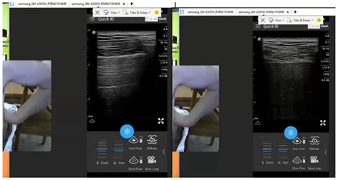 Diagnostics Free Full Text Patient Self Performed Point Of Care