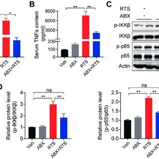 The Gut Liver Axis In Sepsis An Interface Of The Human Host And Its