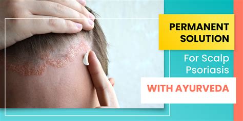 Ayurvedic Treatment For Scalp Psoriasis And Eczema Shuddhi