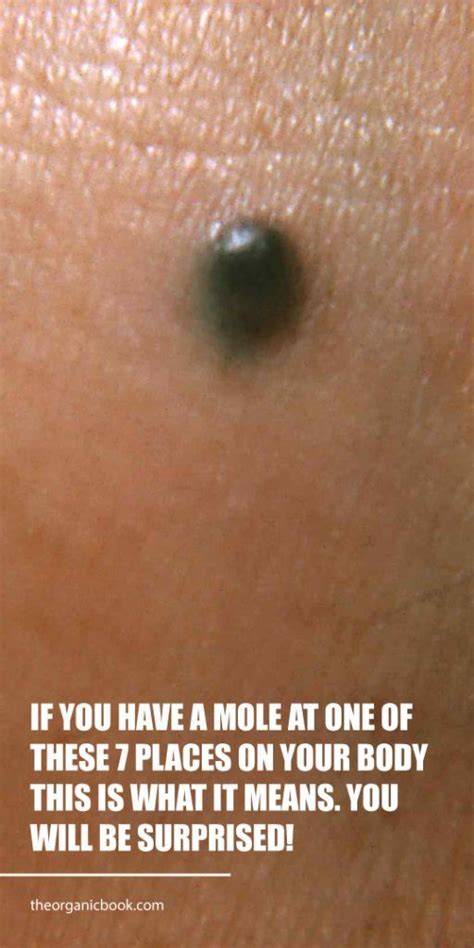 If You Have A Mole At One Of These 7 Places On Your Body This Is What It Means You Will Be