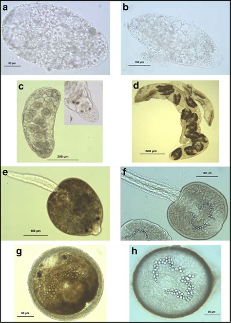 Larval Stages Of C Daubneyi And F Hepatica A Sporocyst Of C