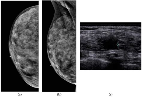 Diagnostics Free Full Text The Role Of Ultrasound In Screening