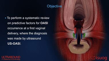 UOG Video Abstract Predictive Factors For Obstetric Anal Sphincter