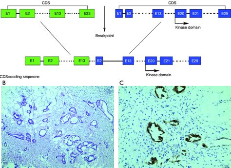 Gene Structure And Pathological Evaluation A Illustration Of The