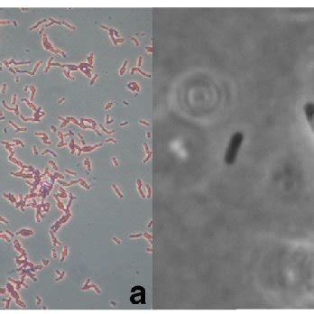 Microscopic Characteristics Of Bacillus Thuringiensis Mybt A