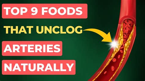 Top 9 Foods That Unclog Arteries Naturally And Prevent Heart Attack