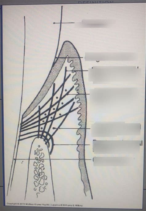 Preclinical Gingival Fiber Group Diagram Quizlet