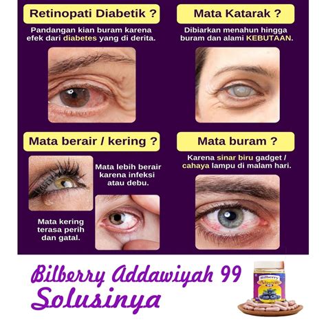 Jual Obat Mata Ekstrak Kapsul Bilberry Adawiyah Untuk Penyembuhan