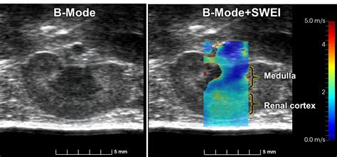 Elastography Sonovol Inc