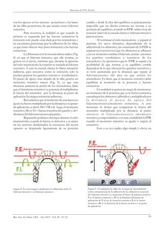 Conceptos Cl Sicos De La Biomec Nica De La Pr Tesis Parcial Removible Pdf