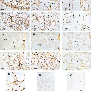 Immunolocalization Of Androgen Receptor Af And Estrogen Receptor